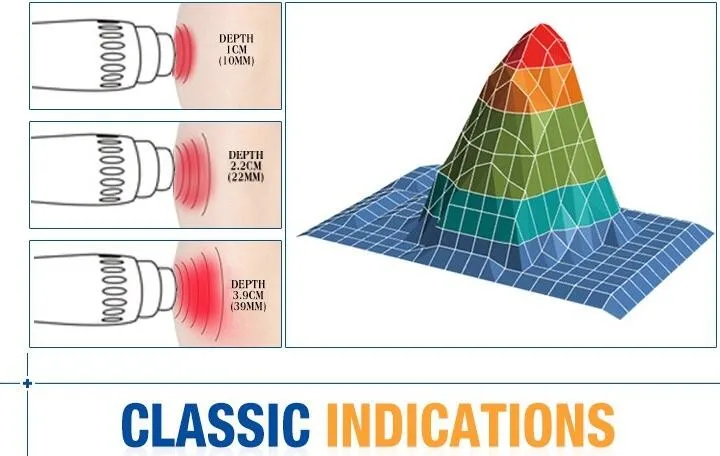 Новая модель! Физическое лечение боли акустическая система Shockwave машина для боли рельефный питчер 8 бар бесконечные снимки