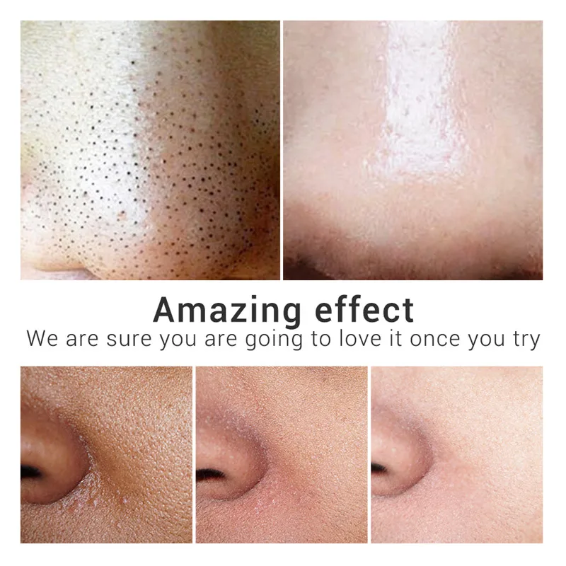 LANBENA Clay Face Mask Bamboo Charcoal Blueberry Rose Deep Cleaning Remove Grease Shrinks Pores Nourishing Skin 1 LANBENA Clay Face Mask Bamboo Charcoal Blueberry Rose Deep Cleaning Remove Grease Shrinks Pores Nourishing Skin 5