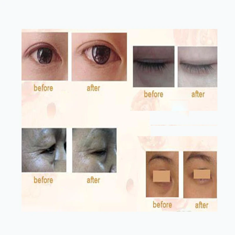 eye-mask2