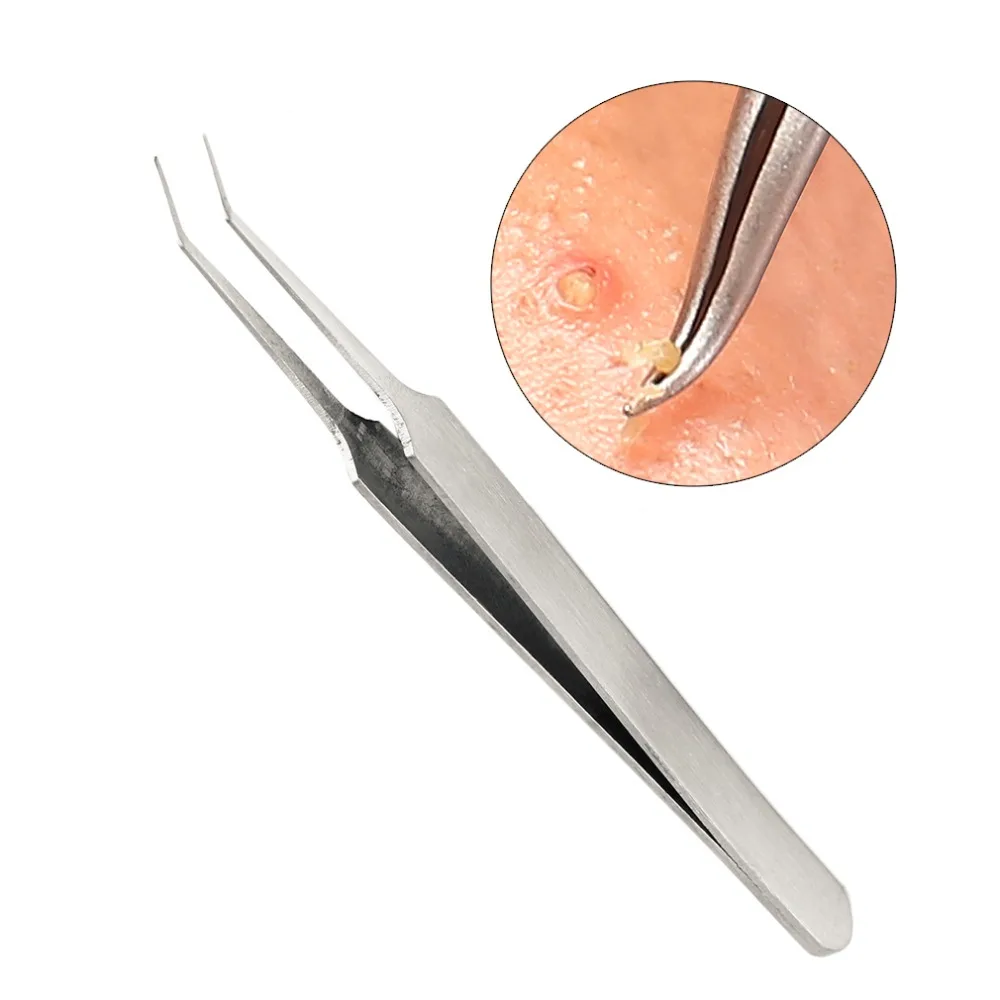 3 pcs Practical Acne Needle Tweezers Blackhead Pimples Removal Pointed Bend Gib Head Face Care Tools Comedone Acne Extractor new