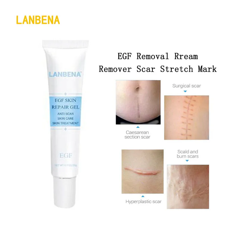

LANBENA removal cream EGF Remover Scar Cream Stretch Mark Gel Anti Acne Cream Acne Treatment Whitening Repair face care