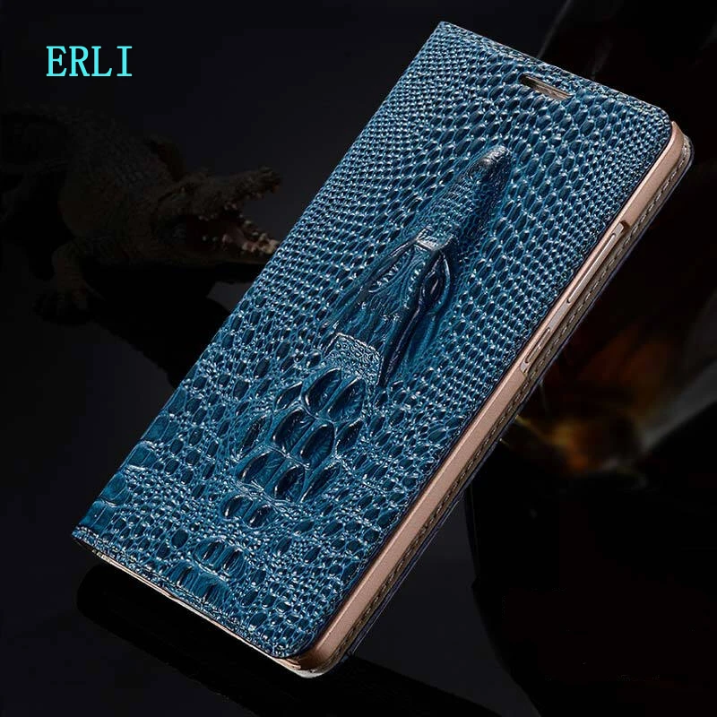 

Luxury Flip Genuine Leather Case For Nokia 3 5 6 TA-1054 TA-1000/3 7 Plus TA-1062 X5 X6 X7 2018