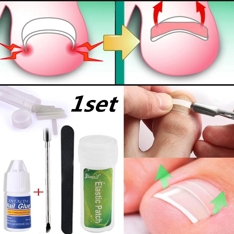 

10pc Inline toenail trimming tools with nail clippers and foot rubbing tools Correction clamp Stretch toenails Thick nail groove