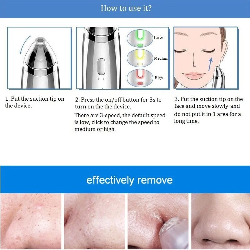 black head remover (3)