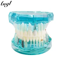 1 шт. взрослых Стоматологическая Смола восстановление модель исследования зубов стоматолога инструменты стоматология лаборатория прозрачная модель