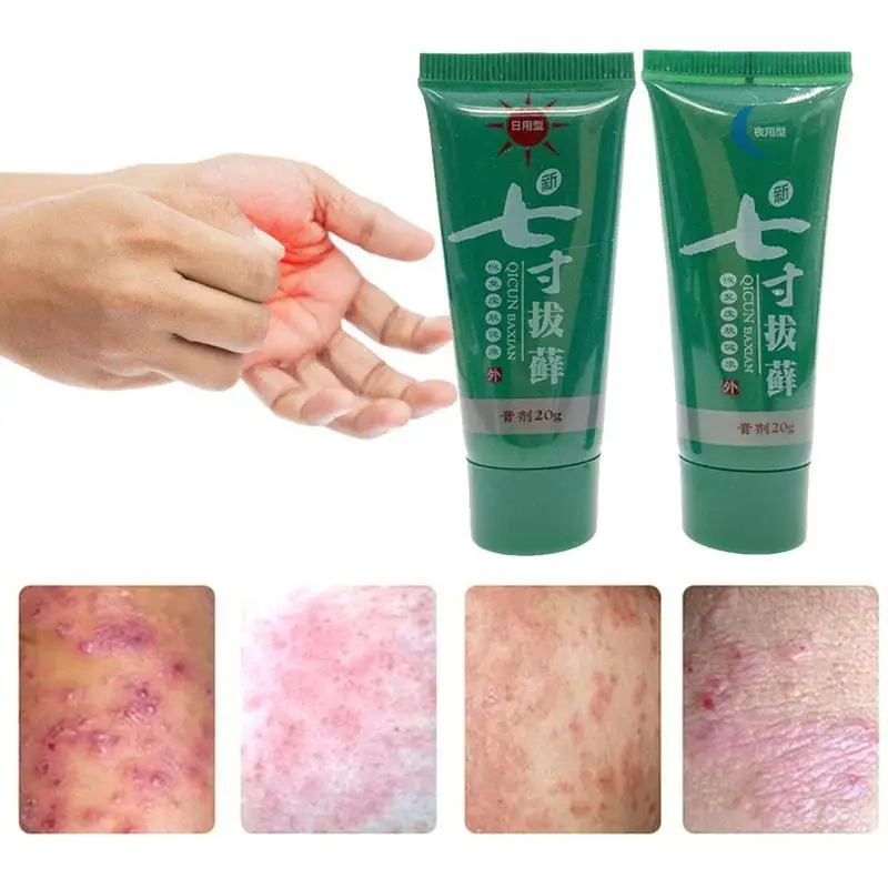 

2pcs Skin Care Cream Skin Psoriasis Cream Dermatitis Eczematoid Eczema Ointment Treatment Psoriasis Cream Hot selling