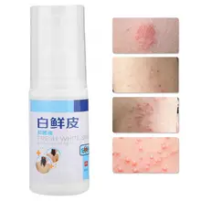 Парфюм для тела, псориаз, удаление запаха тела, раствор для удаления Pruritus, облегчающий спрей, антиперспиранты, дезодоранты, терапия