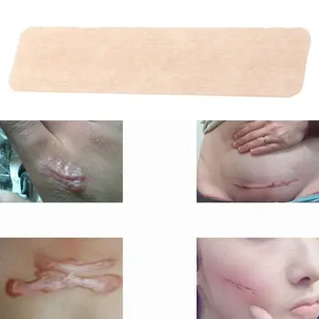 

1 pc Silicone Removal Patch Reusable Acne Gel Scar Therapy Burn Skin Repair Strips