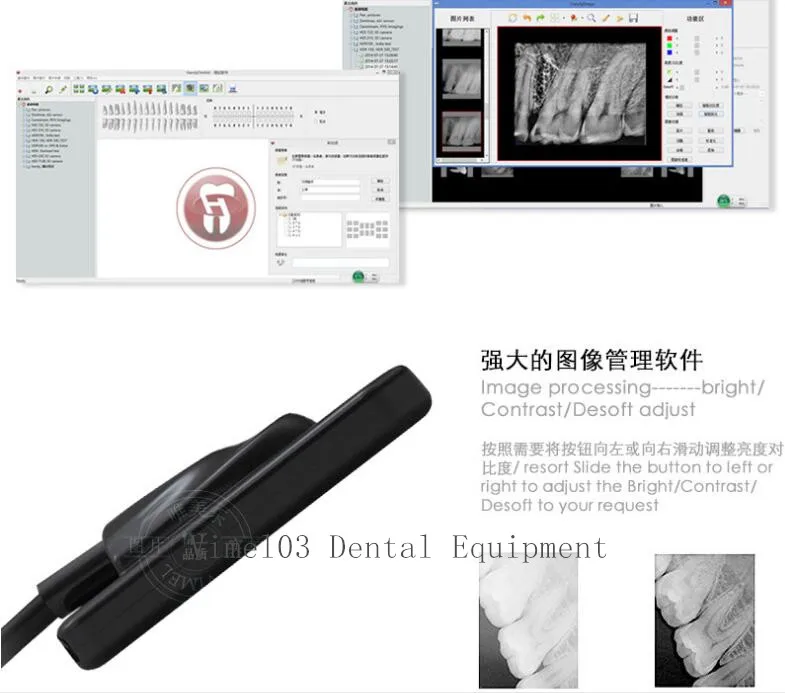 HDR500 стоматологический Цифровой x лучевой датчик рентгеновский блок Интраоральная система визуализации