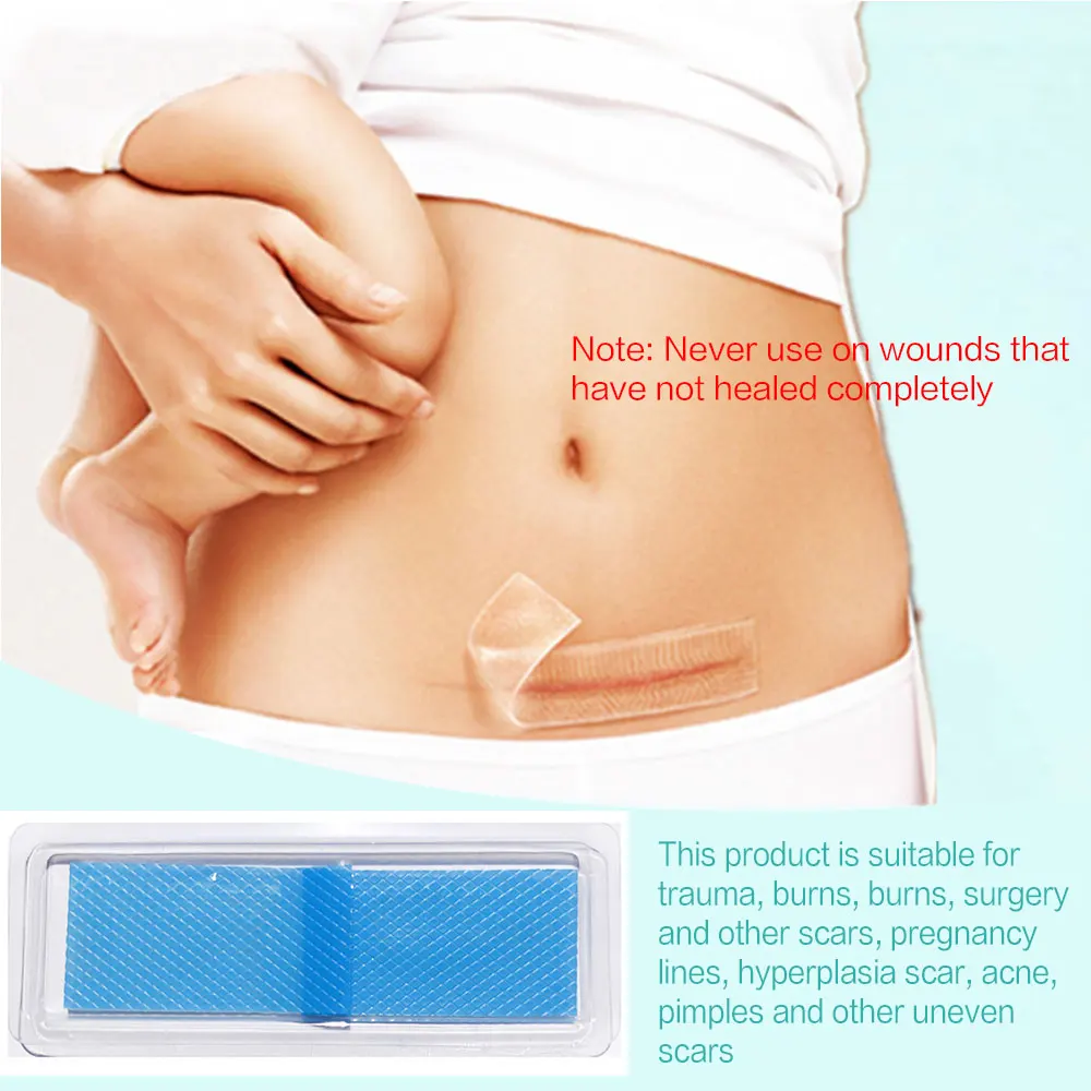 

Reusable Silicone Gel Sheet Scar Removal Patch Gel Scar Therapy Patch Remove Cesarean Keloid Trauma Burn Sheet Skin Repair Stick