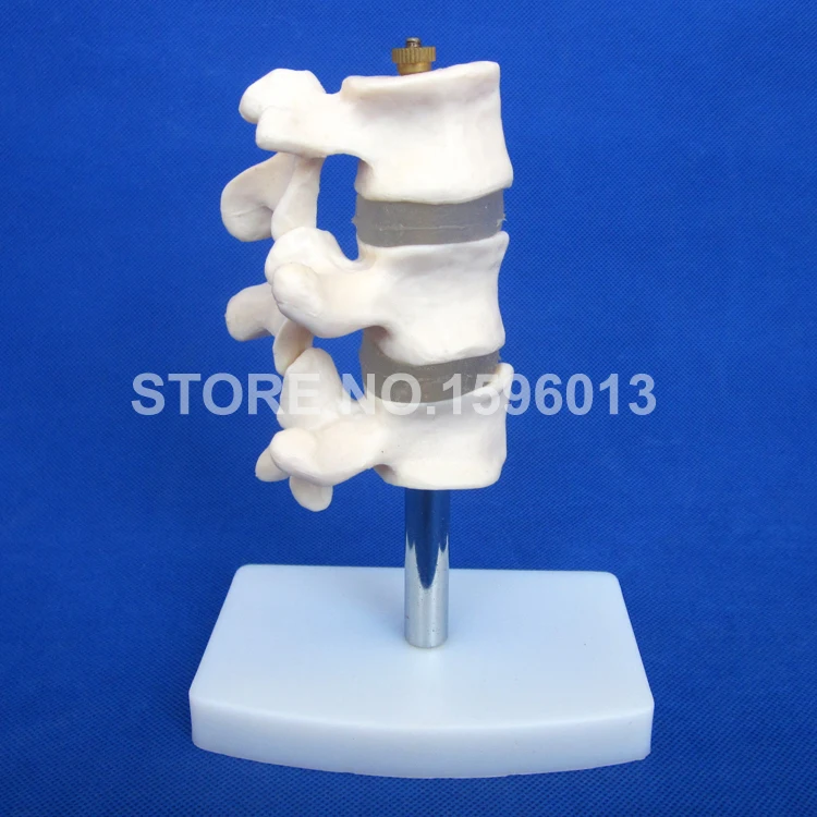 134 osteoporosis model (2)