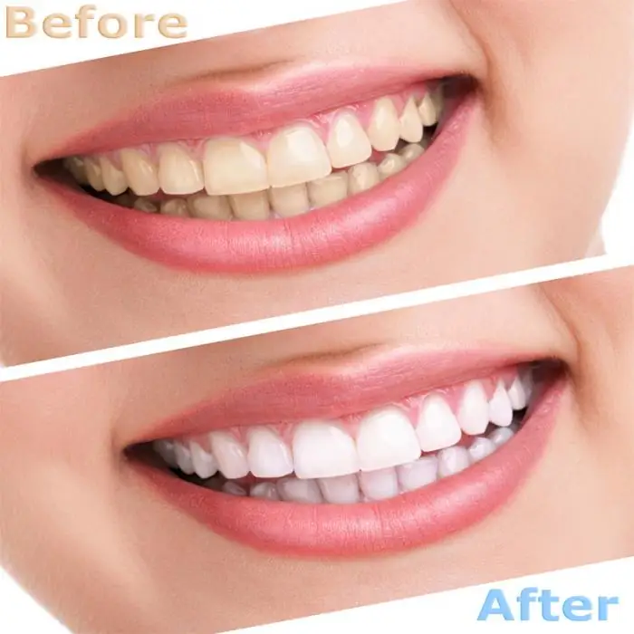 Новое поступление Профессиональный 1 шт. зубная паста пена очищающий, отбеливающий зубной рот чистящая жидкость гигиены полости рта