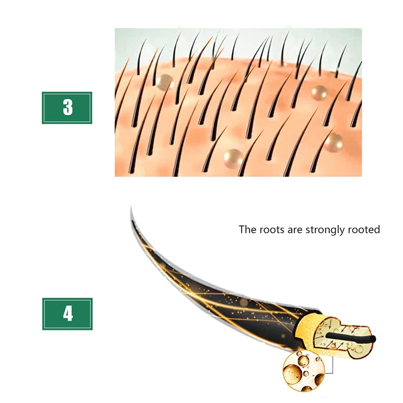 Мощная 30 мл Имбирная Сыворотка от выпадения волос эссенция для женщин и мужчин от выпадения волос жидкий поврежденный ремонт волос растущий быстрый ремонт
