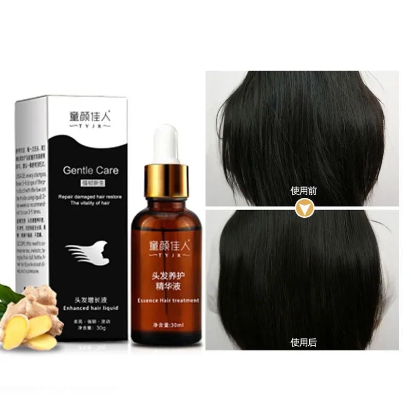 30ml better than Andrea Fast Growth Essence Yuda Pilatory Ginger Shampoo Anti Gray Loss Liquid Damaged hair serum treatment | Красота и
