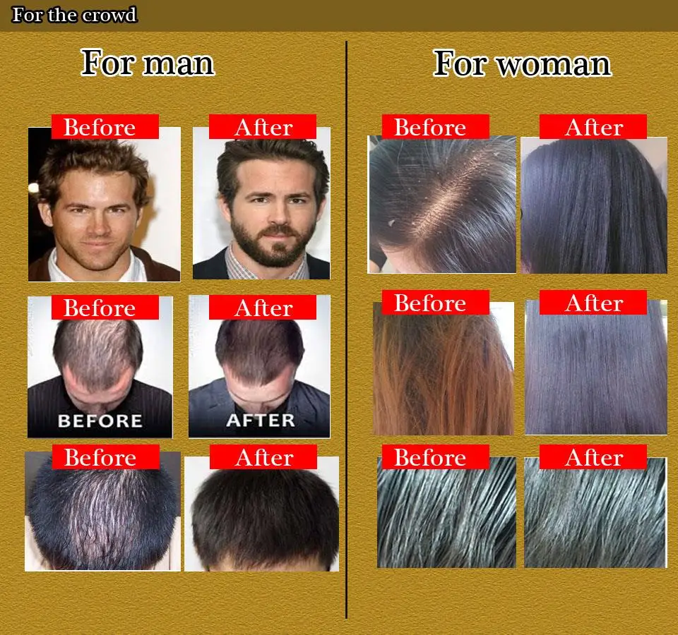 Okeny S 20ml Fast Hair Growth Products For Women Anti Gray Hair