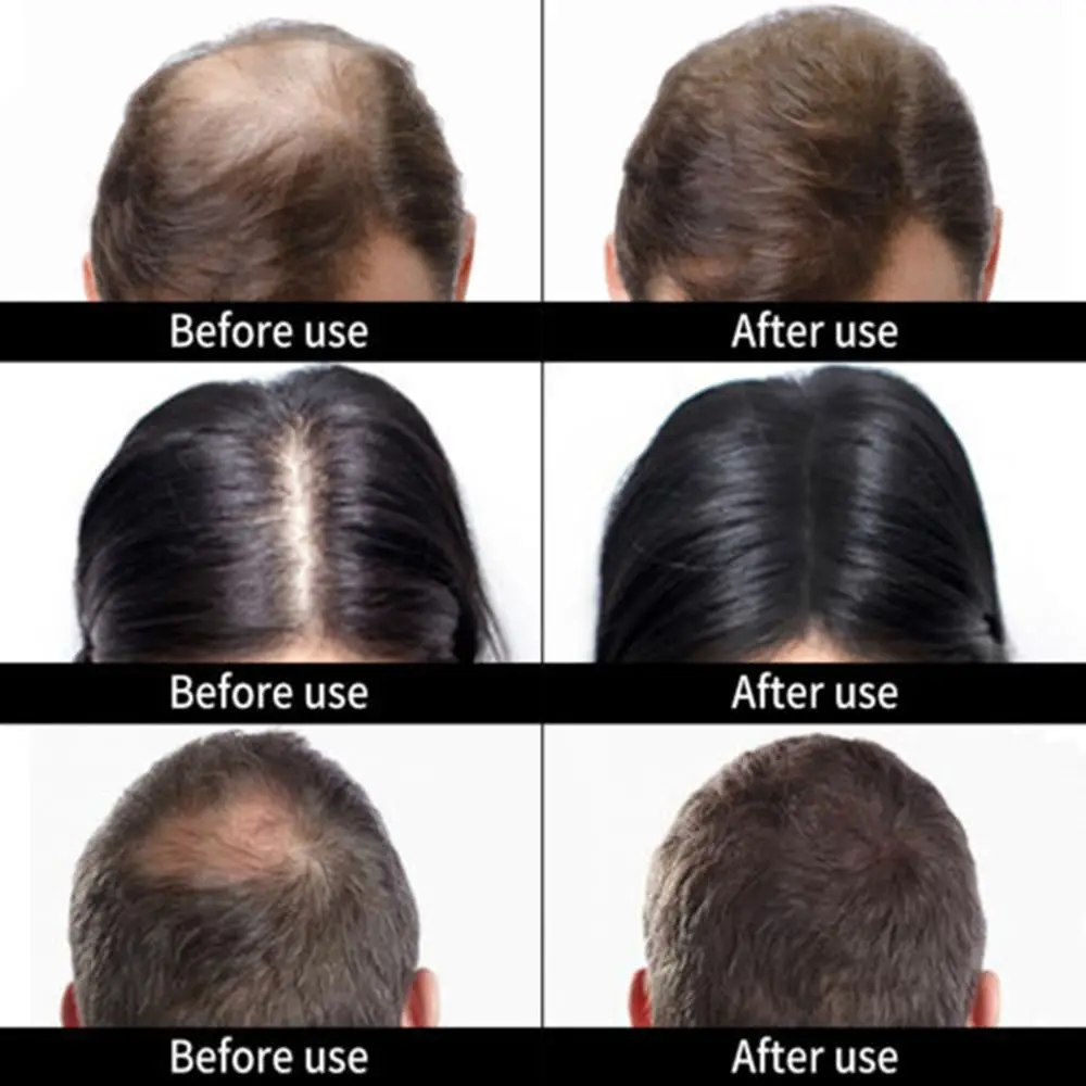Hair Loss Concealer Hair Growth Fiber Keratin Hair Building Fibers Styling Powder Hair Styling