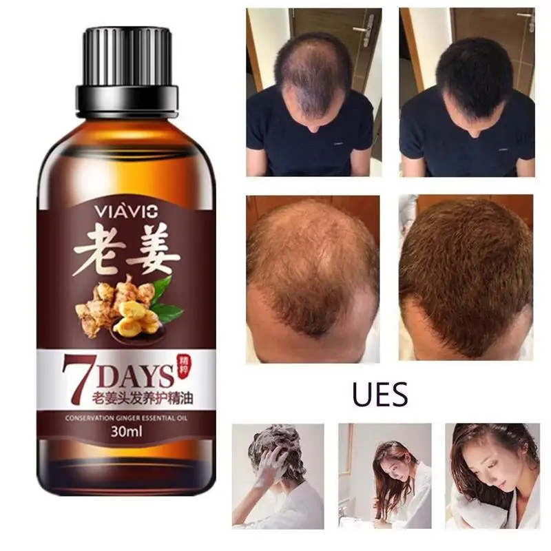 

Hair Regrow Essential Oils 7 Day Ginger Germinal Serum Essence Oil Loss Treatement Hair Growth Serum 30ml