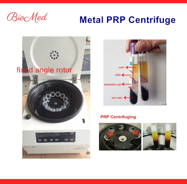 PRP центрифуги, пригодный для platenet обогащенная плазма prp трубки для волос, уход за лицом, кожи и лечения зубов