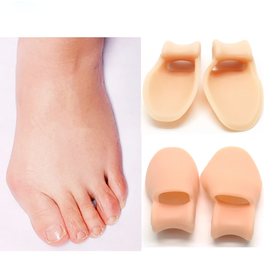 

Single Hole Thumb Valgus Toe Points Hallux Valgus Correction Is Blackmailed Toe Valgus Orthosis Silicone Foot Care Z34601