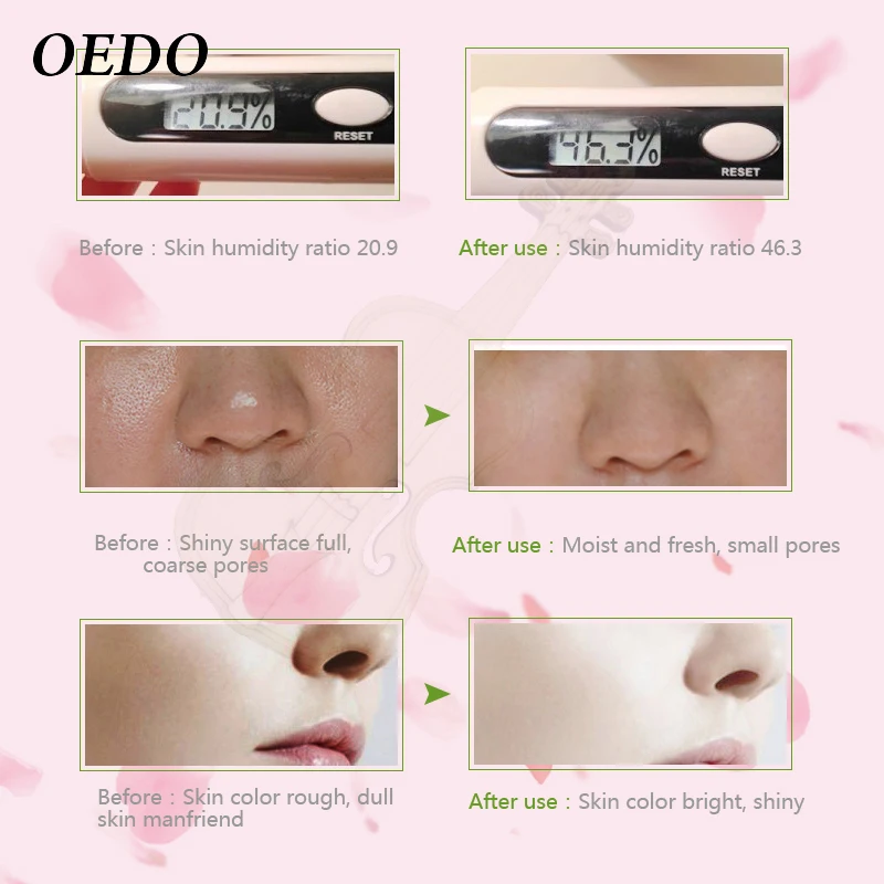  Rose Peptide Firming Face Cream Anti-Wrinkle Moisturizing Lifting Face Firming Cream Anti-Fat V-Lin