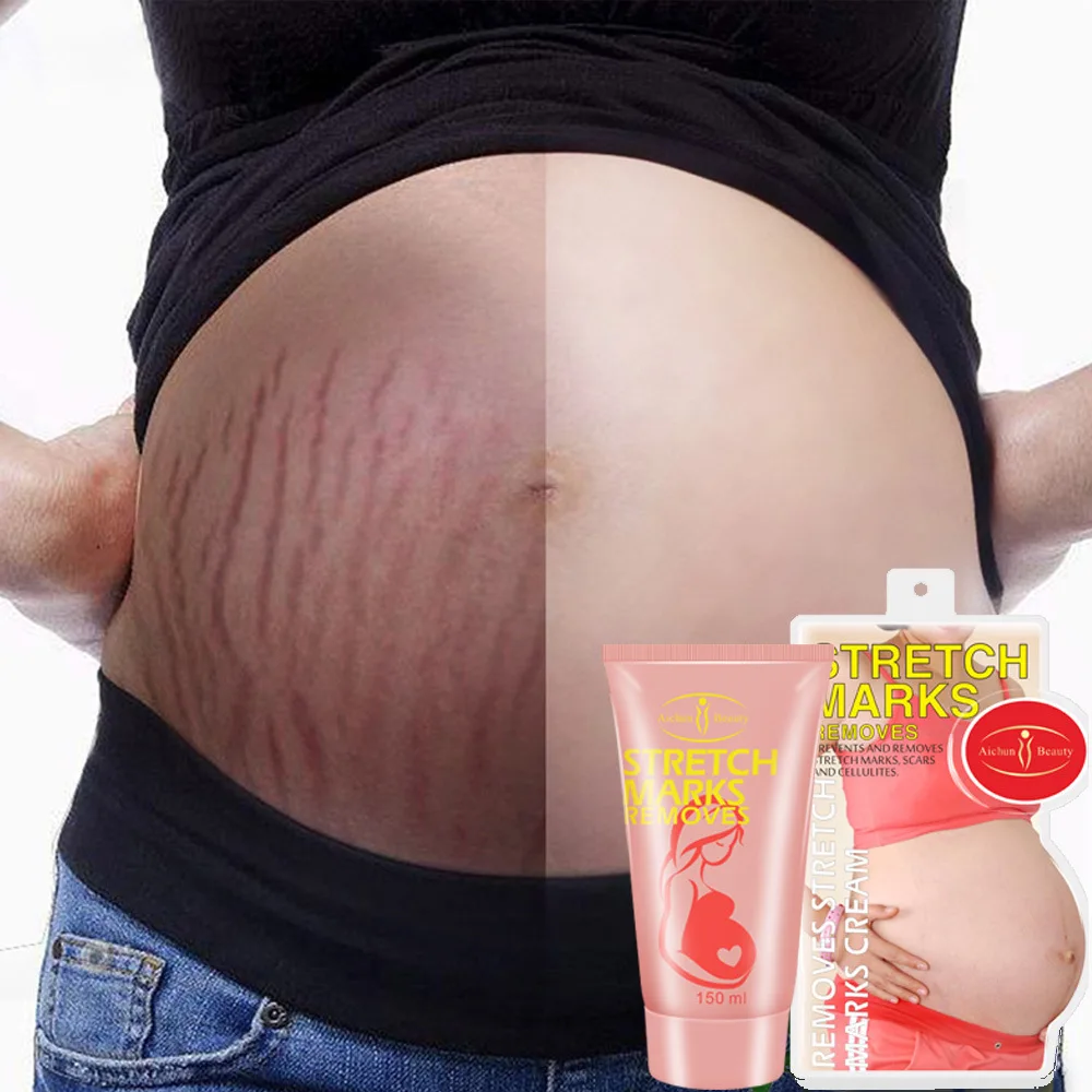 

Aichun Remove Pregnancy Scar Acne Cream Stretch Marks Treatment Maternity Repair Anti-Aging Anti Winkles Firming Body Cream 150g
