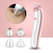Пылесос для удаления угрей, глубокий уход за лицом, Электрический Очиститель пор, угрей, Удаление пор, вакуум, всасывание, уход за кожей лица, инструмент
