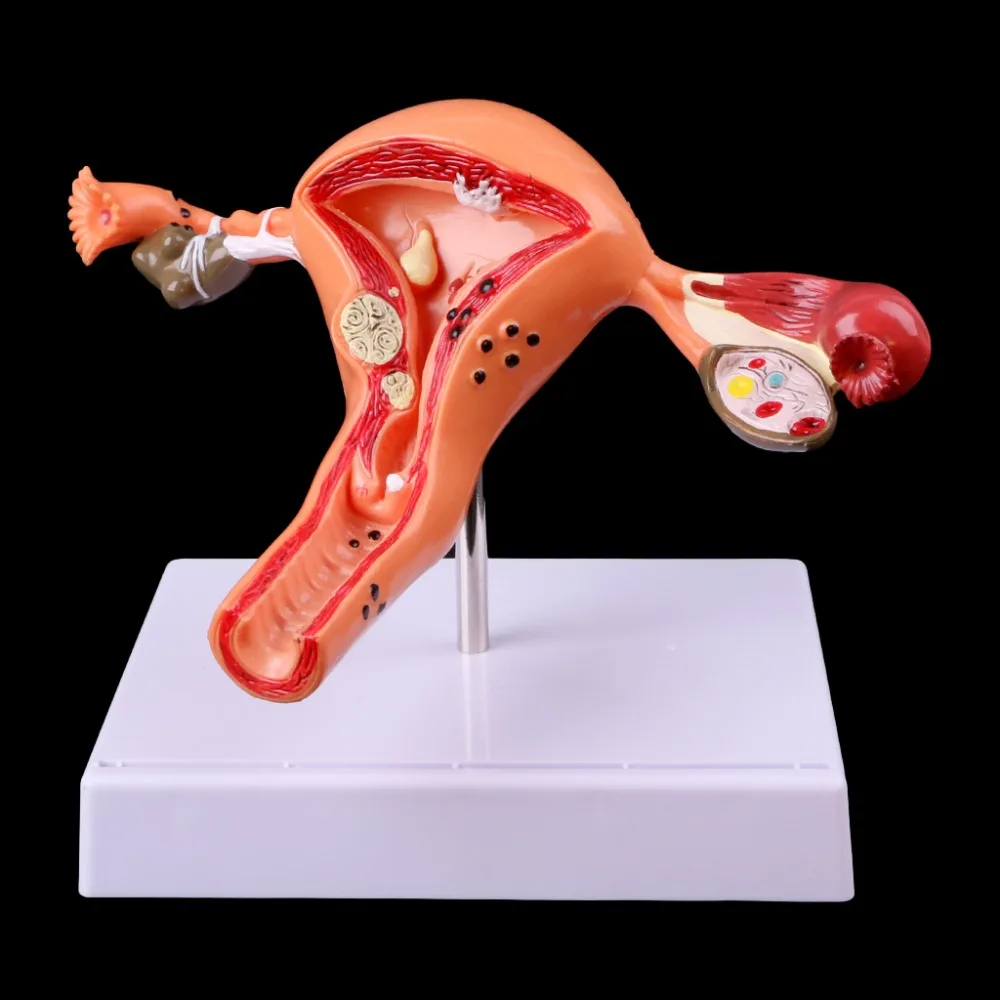 Патологическая матка яичник анатомическая модель Анатомия поперечного сечения инструмент для исследования