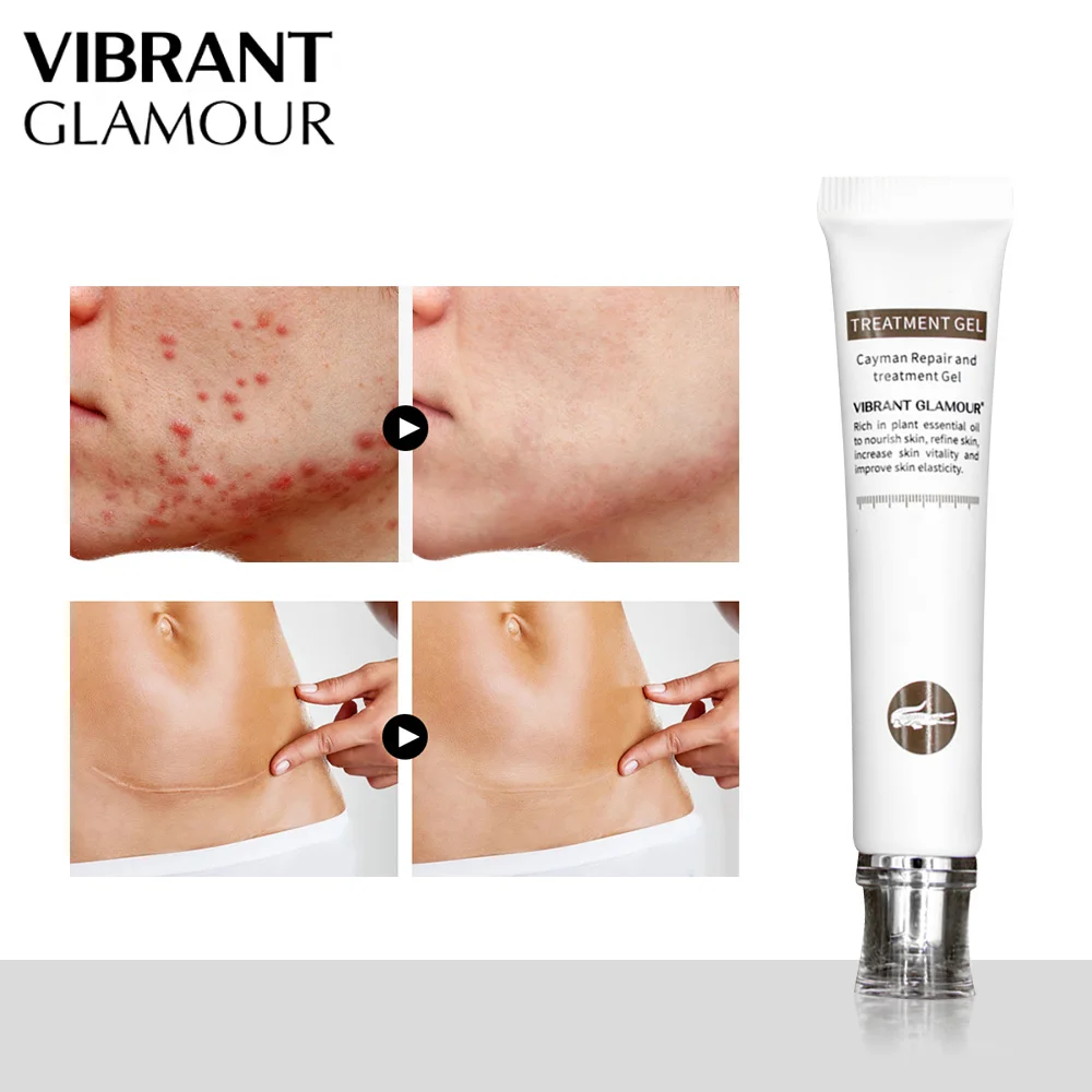 

VIBRANT GLAMOUR Crocodile Acne Scar Removal Cream Treatment Marks for face or body Pigmentation Corrector Skin Care 20g