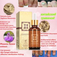 Горячее предложение! Распродажа! Лечение ногтей от грибка с эфирным маслом Уход за ногами и ногтями полировка для ногтей гель пудра «ARMOR Essence» ногтей ног удаление грибка