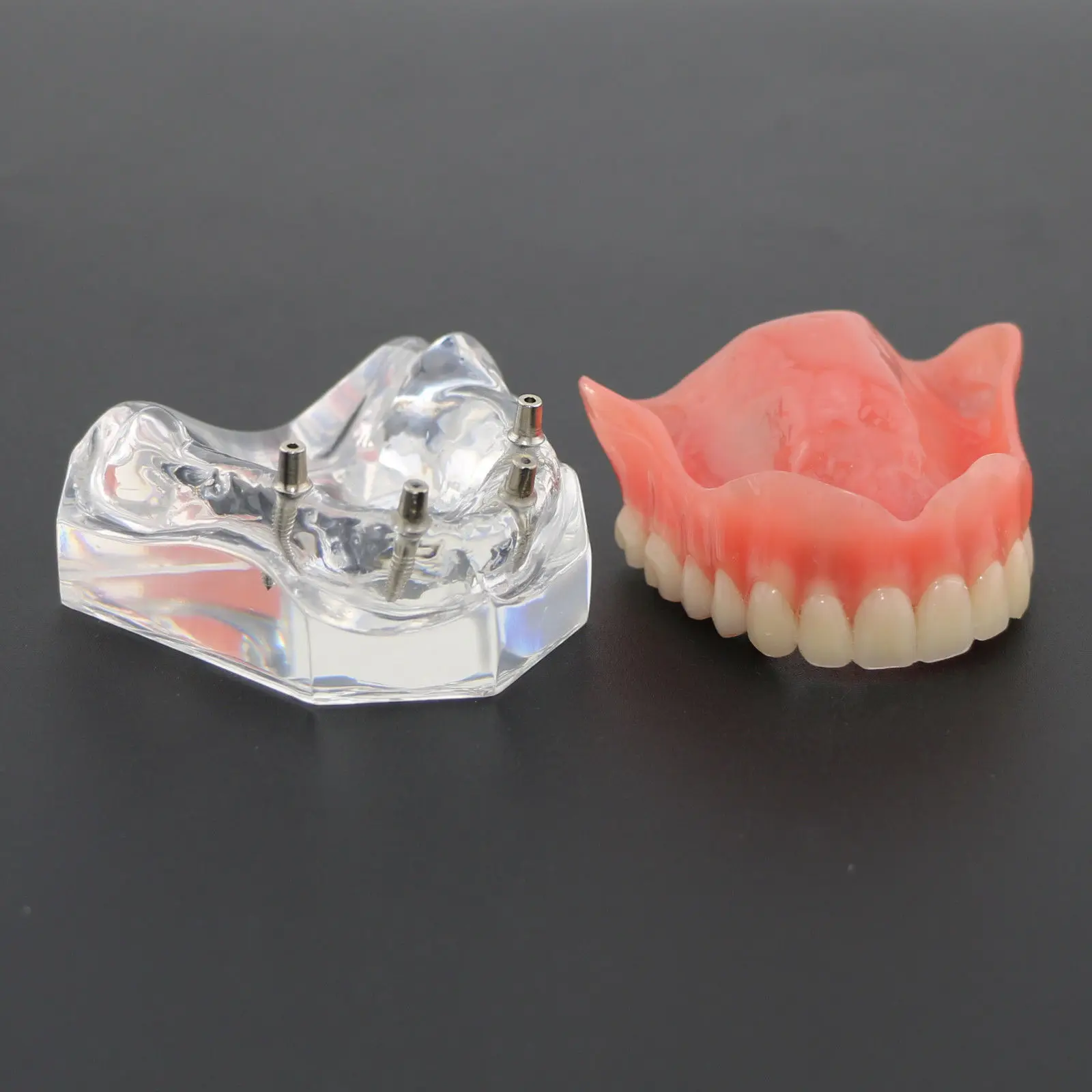 Dental Clear Acrylic Upper Teeth Model Overdenture Superior 4 Implants Maxillary Demo Model 6001
