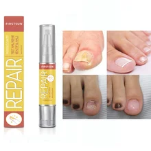 Грибковая ручка для лечения Ногтей onychomicosis Paronychia против грибковой инфекции ногтей решение для ухода за ногтями