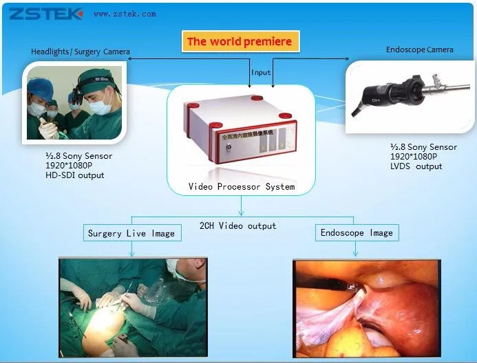 ENDOSCOPE 2CH