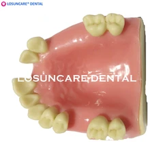 Стоматологическая модель для посадки зубов, модель имплантата нижней челюсти с мягкой десной для медицинского стоматологического образования