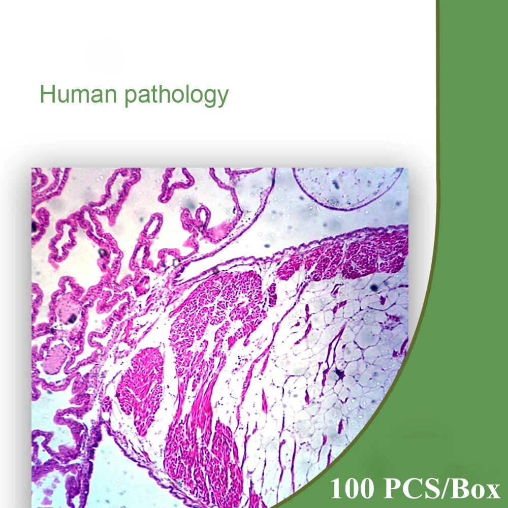 100 шт Профессиональные готовые части патологии человека образцы стеклянные слайды для микроскопа для медицинского университета