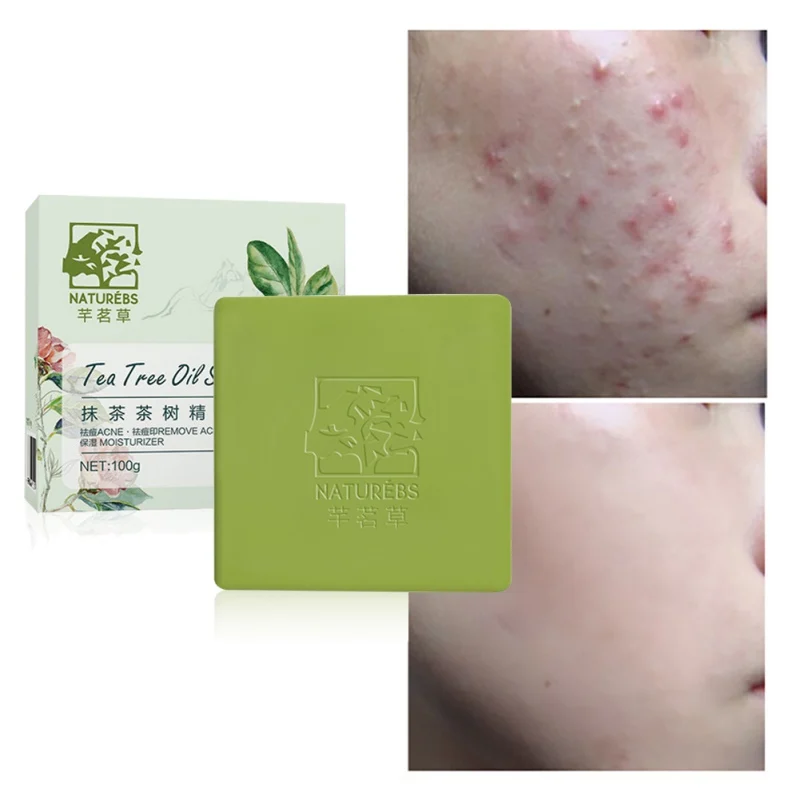 Tea Tree Essential Oil Handmade Soap Moisturizing Acne Remover Soaps Oil Control Cleaning Skin Care p1 Tea Tree Essential Oil Handmade Soap Moisturizing Acne Remover Soaps Oil Control Cleaning Skin Care p1