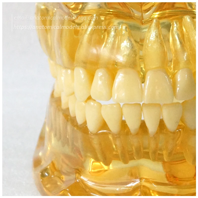 13064 Clear Extraction Model 