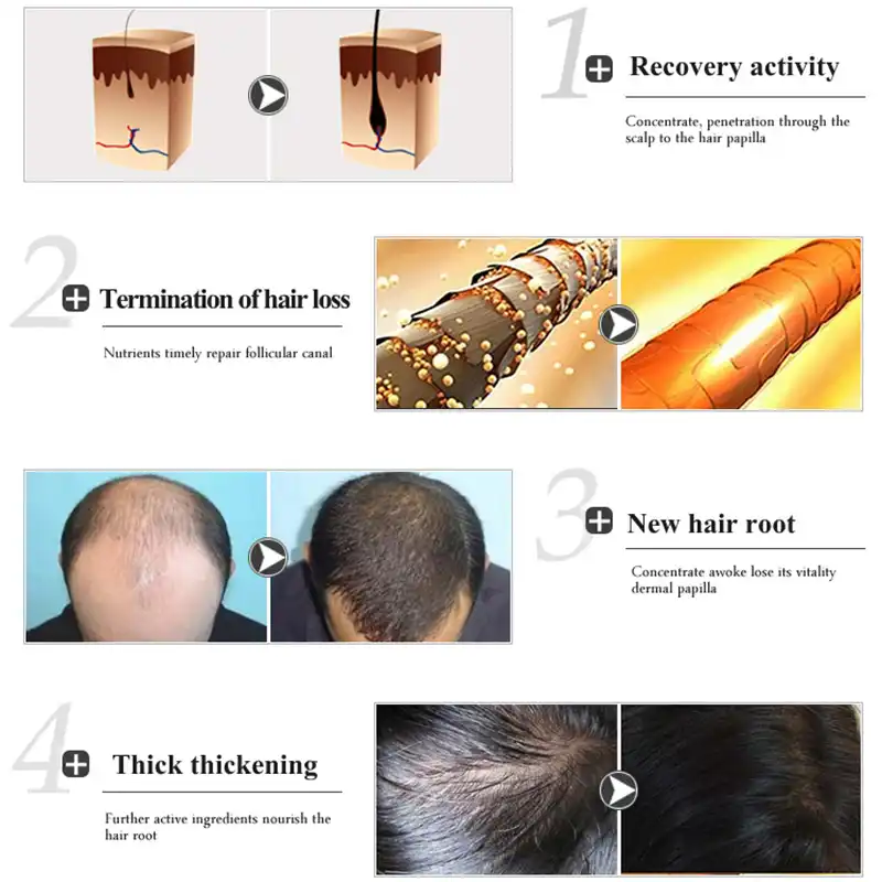 Women Hair Care Liquid Long Hair Fast Growth Shampoo Essence