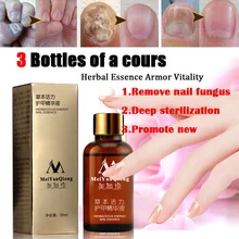 MeiYanQiong Профессиональный Лечение грибка на ногте, экстракт ногтей травянисто-энергии отбеливание стопы ног, Традиционная китайская медицина, средство для удаления грибка ногтей Гель-лак для ногтей