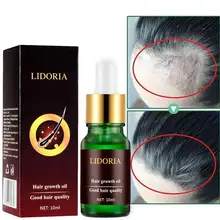 100% çam kozalağı özü Saç Büyüme Yağı ReGrow 7 Gün Zencefil Germinal Saç Büyüme Serumu Kuaför Yağ Kaybı Tedavisi