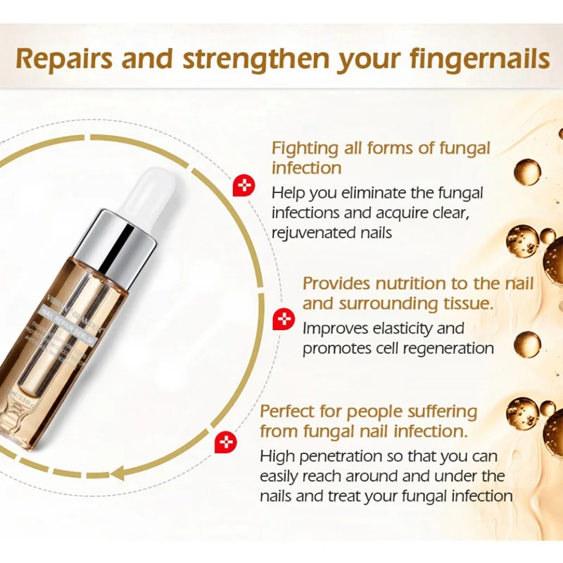 15 мл эффективное лечение грибка для ногтей жидкая эссенция противогрибковый онихомикоз удаление ногтей ноготь Питательный Уход за ногтями