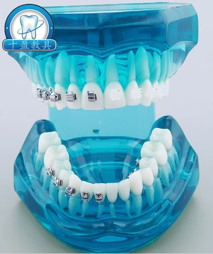 

Dental Orthodontic Teaching Model Ceramic Ceramic Metal Tongue Self-locking 4 Bracket Contrast Demonstration