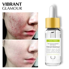 VIBRANT GLAMOUR Tea Tree Face Serum Acne Scar Treatment slime Green Tea Oil Control Essence Anti pockmark Sensitive Skin Care VIBRANT GLAMOUR Tea Tree Face Serum Acne Scar Treatment slime Green Tea Oil Control Essence Anti pockmark Sensitive Skin Care