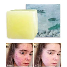 Отбеливающее туалетное мыло для морской соли удаление клещей путешествия пакет туалетное мыло Удаление прыщей поры лечение акне, увлажнение лица
