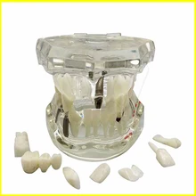 Зубной имплантат демонстрационная подставка моделирование зубов Модель зубы Съемный
