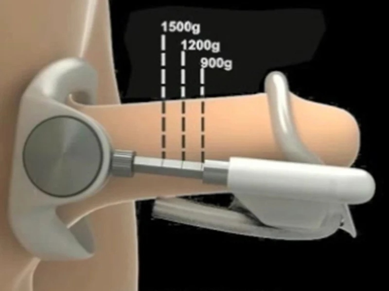 Проэкстендер 3-го поколения Penes расширитель системы увеличения края носилки ремень насоса мужской член увеличители Peni-s насос устройство