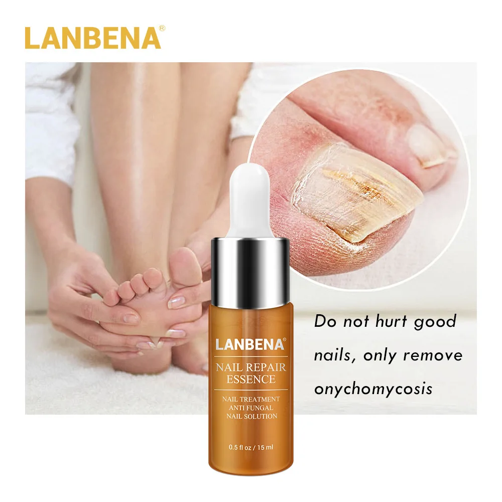 

10ml Nail Fungus Treatment Cream Onychomycosis Paronychia Anti Fungal Nail Infection Kills 99.9% Bacteria and Fungus