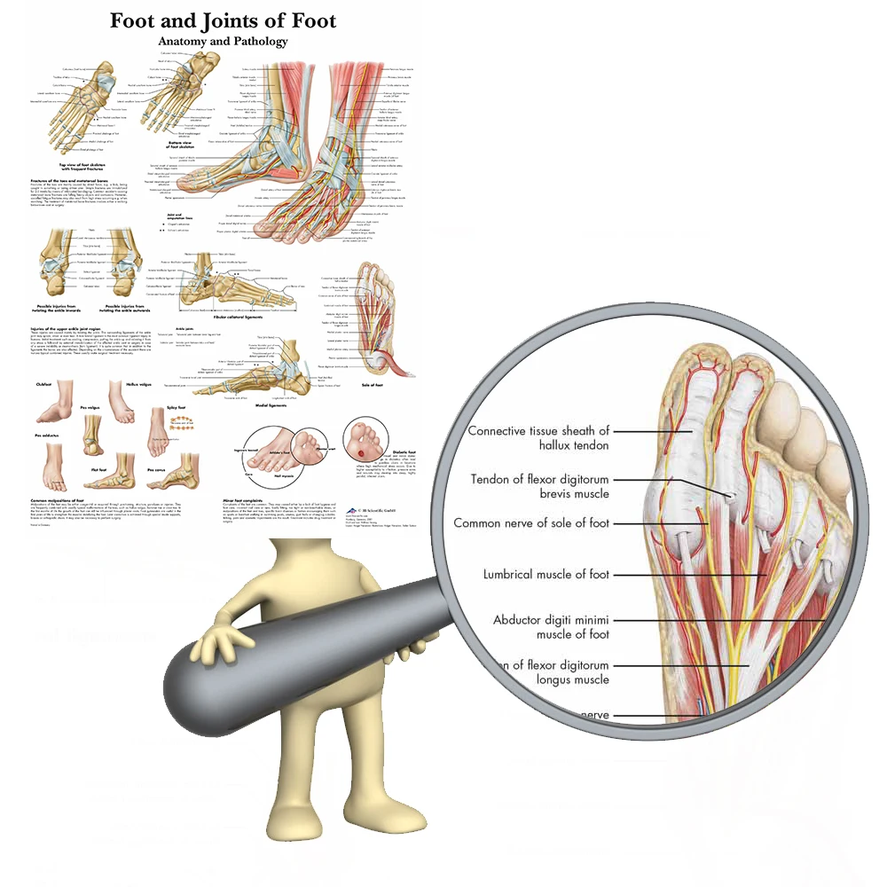 Суставы стопы диаграмма анатомия патологии плакат холст живопись настенные картины для медицинского образования доктора офис класс