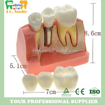 

Dental Equipment Implant Crown Bridge Demonstration Teeth Model