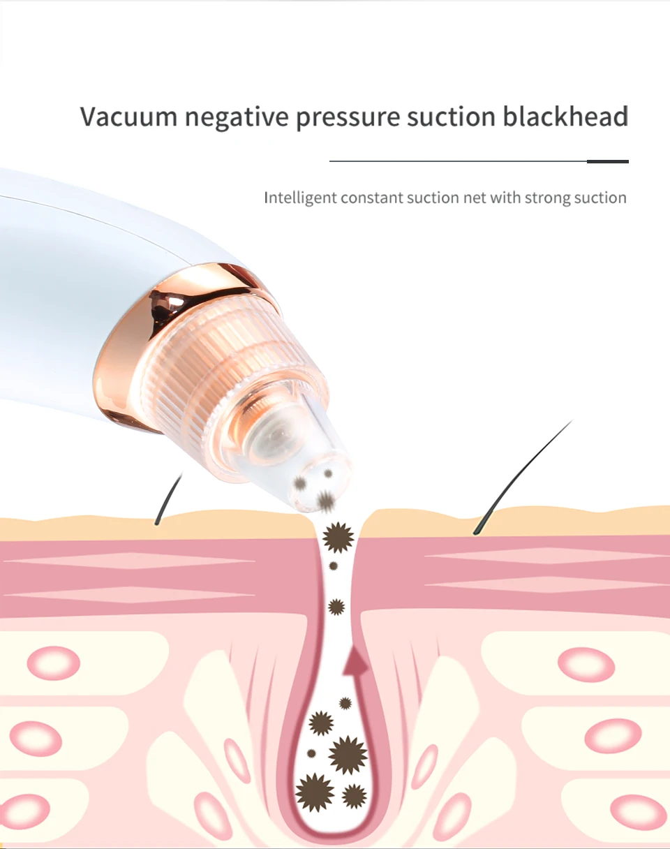 Очиститель пор для удаления черных точек вакуумный Электрический Нос лицо глубокое очищение кожи уход машина подарок на день рождения дропшиппинг красота инструмент