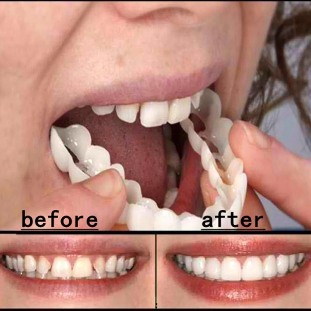 

Comfortable Snap On Men Women Tooth Instant Perfect Smile Comfort Fit Flex Teeth Fits Whitening Smile False Teeth Cover